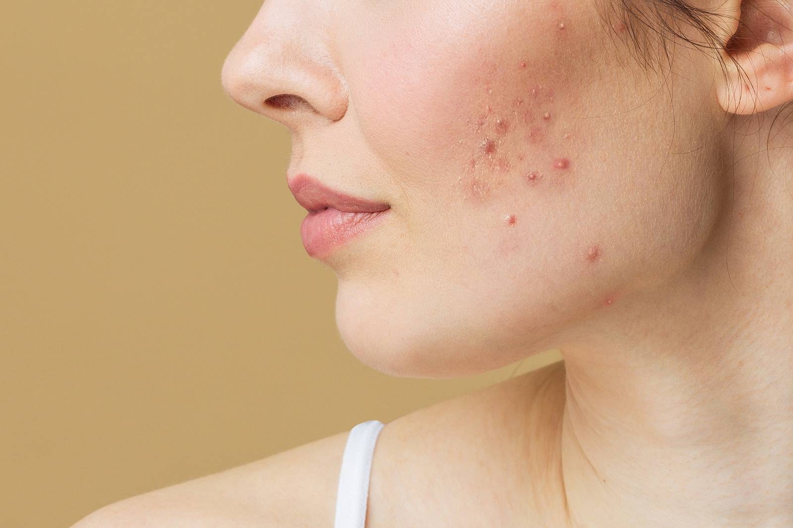 Signs You Need To See a Dermatologist 2