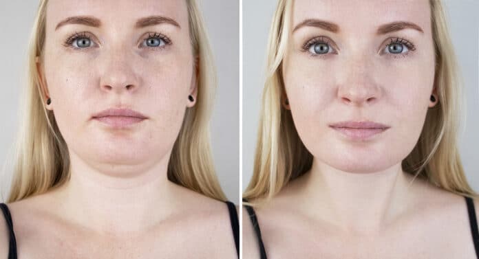 How To Lose Face Fat A Beginner's Guide (3)