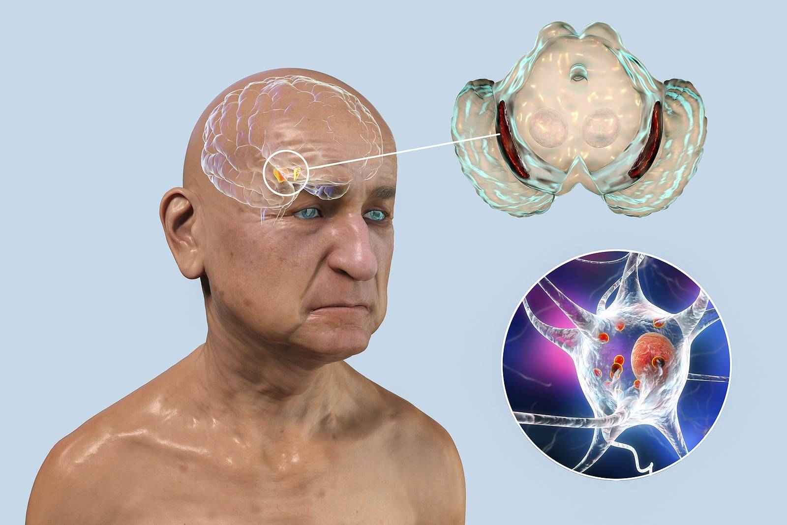 How do you Check for Parkinson's Disease?